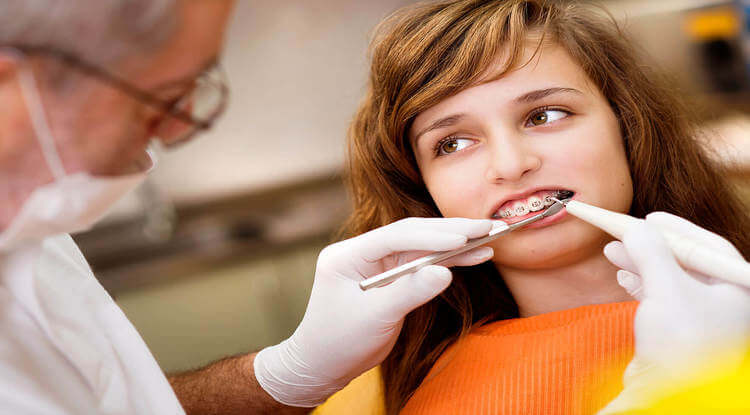 Braces Adjustment