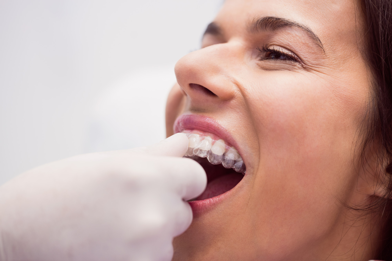 Invisalign Orthodontist