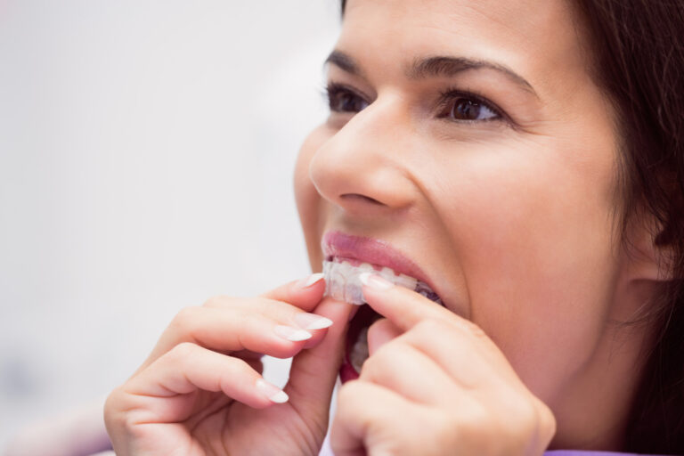 Invisalign Orthodontist