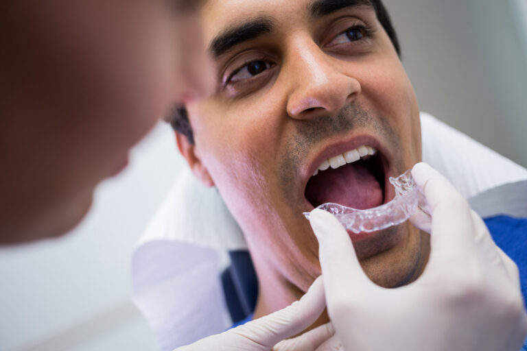 Facts About Invisalign